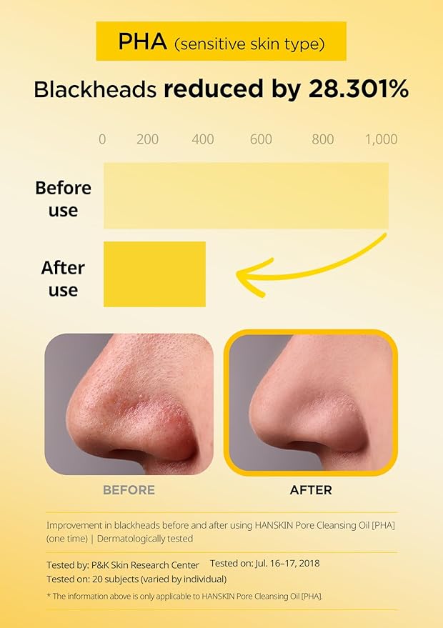Hanskin Pore Care Duo – PHA Cleansing Oil (6.76 oz) & Cleansing Foam | Blackhead Removal, Gentle Exfoliation & Pore Care for Oily, Acne-Prone & Combination Skin | Korean Skincare Set, K-Beauty