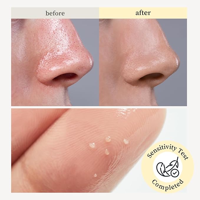 NOONI Korean Cleansing Oil - Snow Aqua 0 LHA Toning Cleansing Oil *2ea | Makeup Blackhead Remover, Pore Control, Glass Skin, Help Control Sebum, Revitalizing, Preppy Stuff, 6.76 Fl Oz x 2