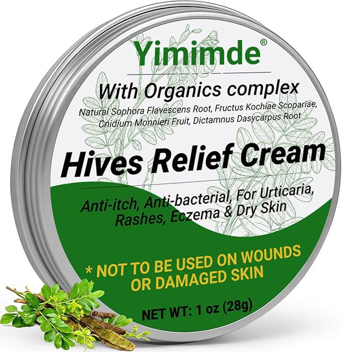 Hives Relief Urticaria Cream, Fast Acting Hives Treatment & Anti-Fungal Anti-Itch Cream for Allergic Rashes, Eczema, Itchy Skin, Redness & Swelling | All Natural Herbal Organic Complex, 1 Oz