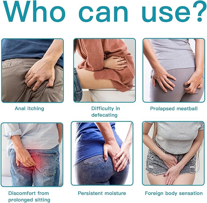 Hemorrhoids Cream，Hemorrhoid Ointment ，Natural Herbs Fast Acting Ingredients，Natural Hemorrhoid Ointment for Men and Women