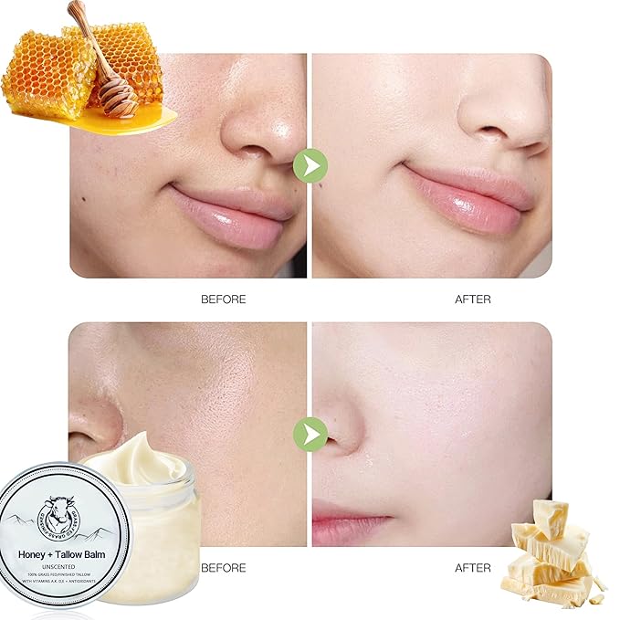 Grass Fed Honey & Tallow Balm, Grass Fed Beef Tallow Manuka Honey Cream, Miracle Tallow Balm Face and Body For Skin, Organic Moisturizing Cream Smooth Skin