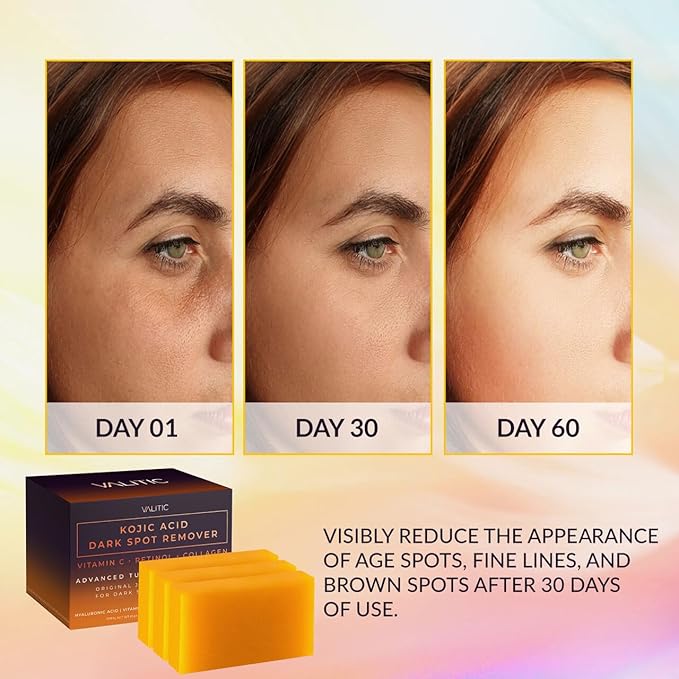 VALITIC Kojic Acid Dark Spot Corrector Soap Bars with Vitamin C, Retinol, Collagen, Turmeric - Original Japanese Complex - Hyaluronic Acid, Vitamin E, Shea Butter, Castile Olive Oil - With Bag