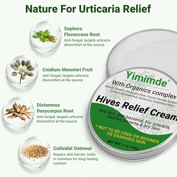 Hives Relief Urticaria Cream, Fast Acting Hives Treatment & Anti-Fungal Anti-Itch Cream for Allergic Rashes, Eczema, Itchy Skin, Redness & Swelling | All Natural Herbal Organic Complex, 1 Oz