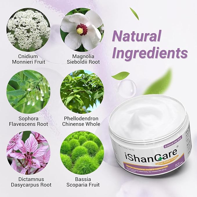 ishancare Urticaria Cream, Fast Acting Relief of Hives, Allergic Rashes, Itchy Skin, Redness, Swelling, Anti Fungal Hives Cream with All Natural Herbal Ingredients, 3.53 Oz
