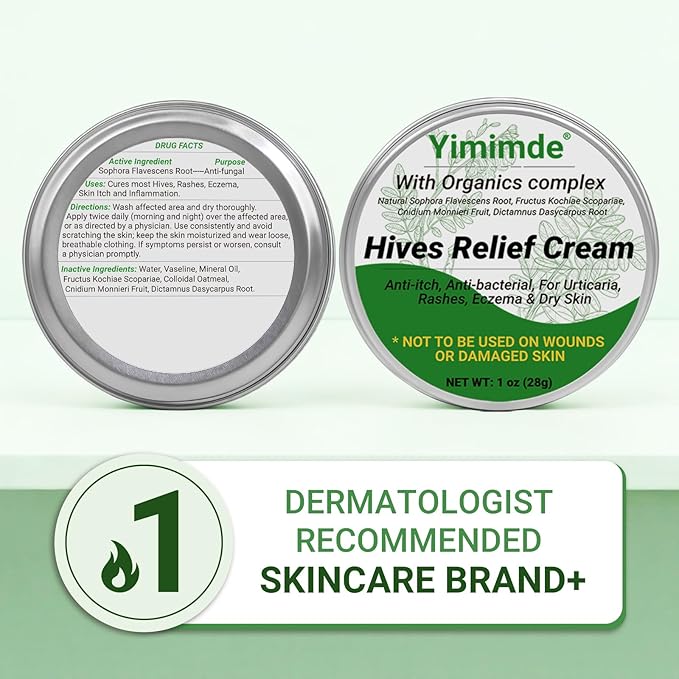 Hives Relief Urticaria Cream, Fast Acting Hives Treatment & Anti-Fungal Anti-Itch Cream for Allergic Rashes, Eczema, Itchy Skin, Redness & Swelling | All Natural Herbal Organic Complex, 1 Oz
