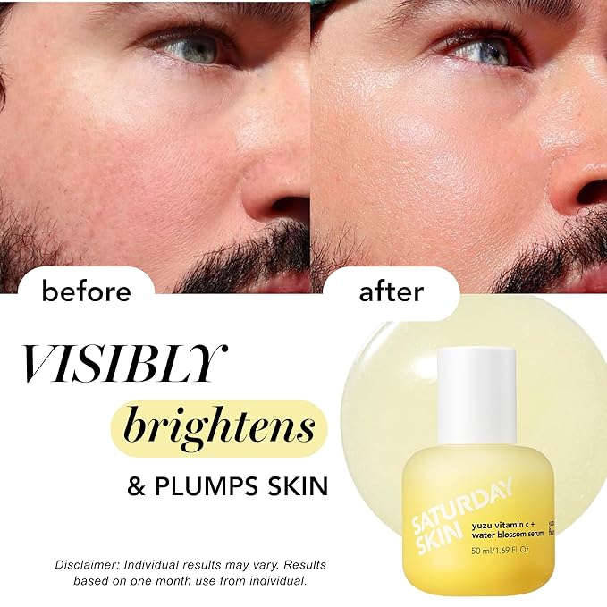 Saturday Skin Yuzu Vitamin C Serum for Face – Brightening Serum Hyaluronic Acid, Peptides & Niacinamide, Vitamin C Glass Skin Peptide Serum, Korean Beauty Vitamin C Serum, Korean Skin Care (30 ml)