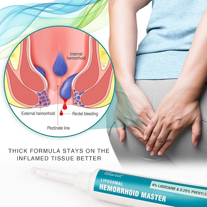 Ebanel 4% Lidocaine Hemorrhoid Treatment Ointment with Phenylephrine, Hydrocortisone, Vitamins B6, D3, E, Zinc Oxide, External and Internal Hemorrhoids Treatment Burn Itch Pain Relief Anal Cream