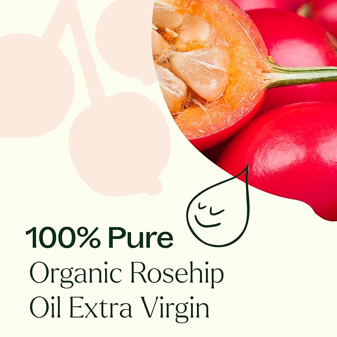 Plant Therapy Organic Rosehip Carrier Oil 4 oz For Skin and Hair Cold Pressed Supports Skin Hydration Fine Lines & Wrinkles Extra Virgin, Vitamins A and E & Essential Fatty Acids