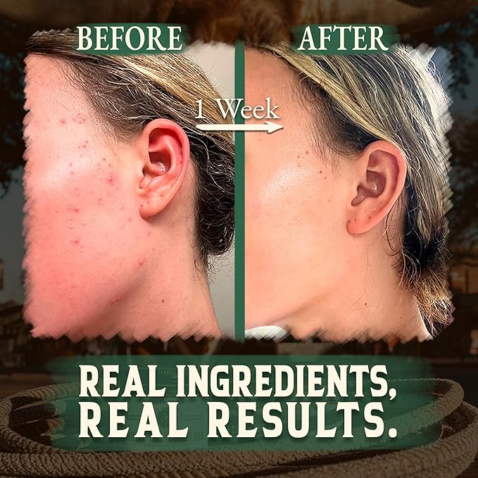 Organic Beef Tallow for Skin -2OZ (Eucalyptus, Concentrated) — Grass Fed Beef Tallow for face + Body — US-Made Tallow and Honey Balm Moisturizer for Dry & Sensitive Skin,Eczema,Rosacea (No Additives)