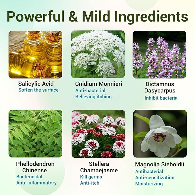 Psoriasis Cream, Maximum Strength Treatment Moisturizing Cream for Psoriasis, Dermatitis, Rash, Anti-Itch, Redness, Flaking, Scaling, Fast Acting Relief for Irritated, Dry Skin 3.53OZ