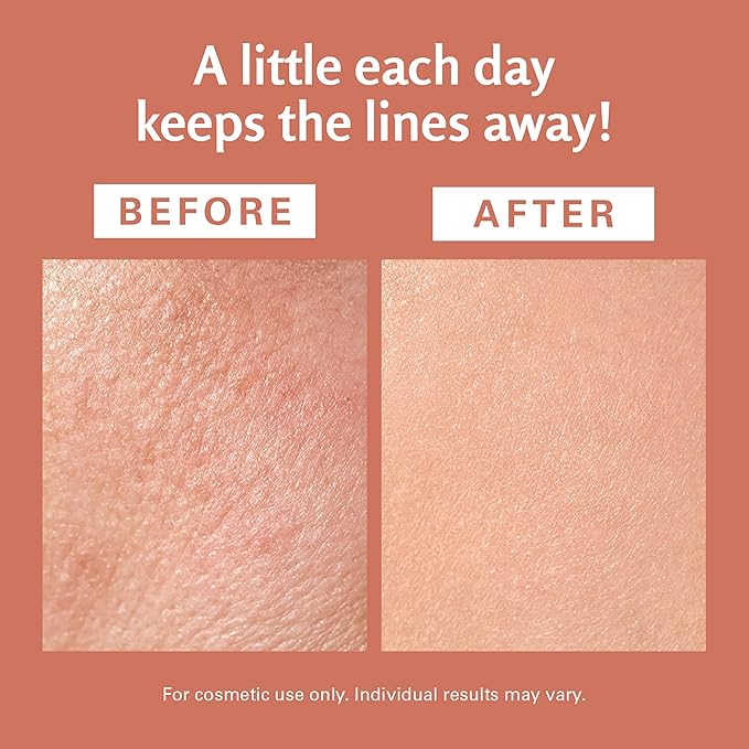 Frankincense Essential Massage Oil for Scars, Stretch Marks & Fine Lines, Firming, Hydrating, Smoothing & Calming Formula with Collagen, Stem Cells, Lavender & Grapefruit, 8 fl oz, by M3 Naturals