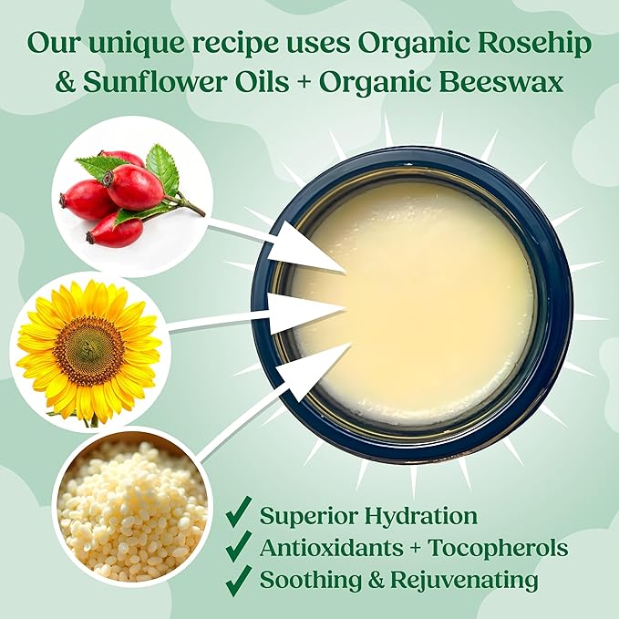 Organic Beef Tallow Balm with Frankincense, Lavender, & Rosehip Oil, 2 oz – Hand Made in USA Tallow Moisturizer for Dry, Sensitive Skin, Rosacea, Eczema | Natural Hydration for Face & Body