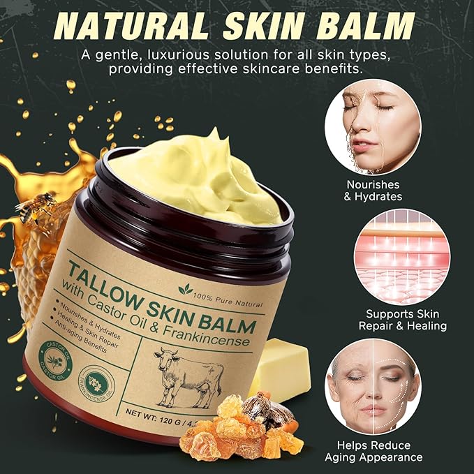 Beef Tallow for Skin & Face Cream with Castor Oil and Frankincense,120g,Organic Natural 100% Grass Fed,Whipped Beef Tallow Balm Deeply Moisturizing for Face & Body Care,4.2 oz